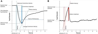 Characterising cerebrovascular reactivity and the pupillary light response–a comparative study